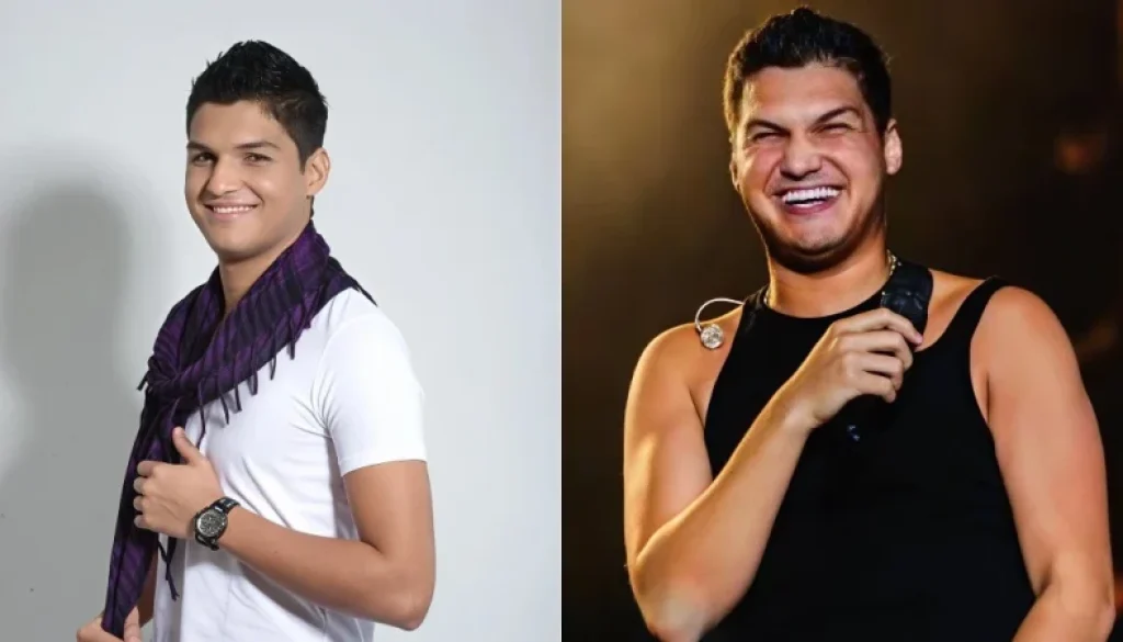 Elder Antes y después Vallenato FM Elder antes y después